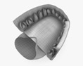 치과 임플란트 3D 모델 