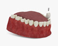 Зубний імплантат 3D модель