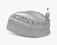 Impianto dentale Modello 3D