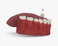 Zahnimplantat 3D-Modell