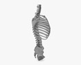 脊椎固定システム 3Dモデル