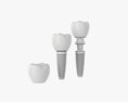 Tooth Implant Modelo 3d