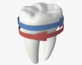 Tooth Molars With Arrow 02 Modelo 3D