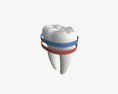 Tooth Molars With Arrow 02 3d model
