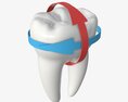 Tooth Molars With Arrow 01 3D-Modell