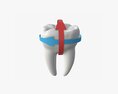 Tooth Molars With Arrow 01 3D 모델 